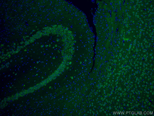 NSE Antibody in Immunohistochemistry (PFA fixed) (IHC (PFA))