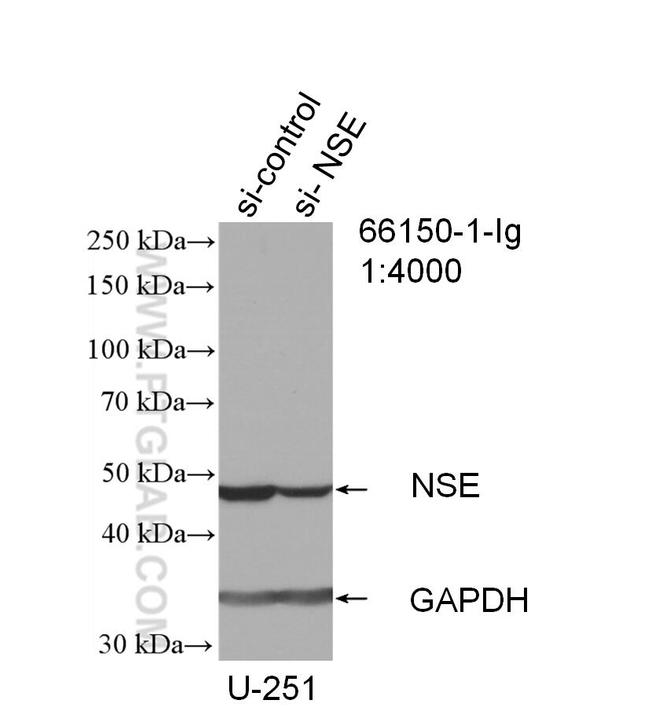 NSE Antibody in Western Blot (WB)