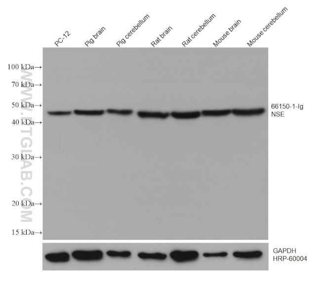 NSE Antibody in Western Blot (WB)