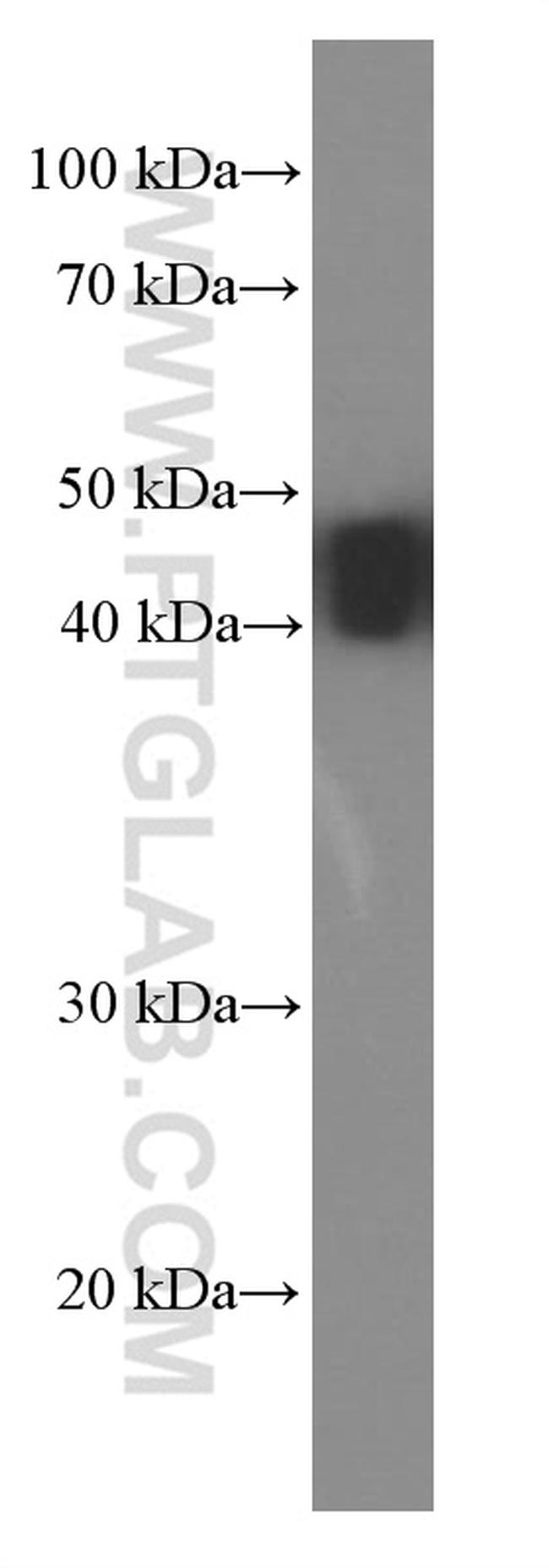 NSE Antibody in Western Blot (WB)