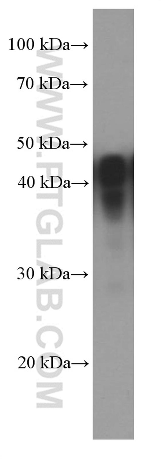 NSE Antibody in Western Blot (WB)