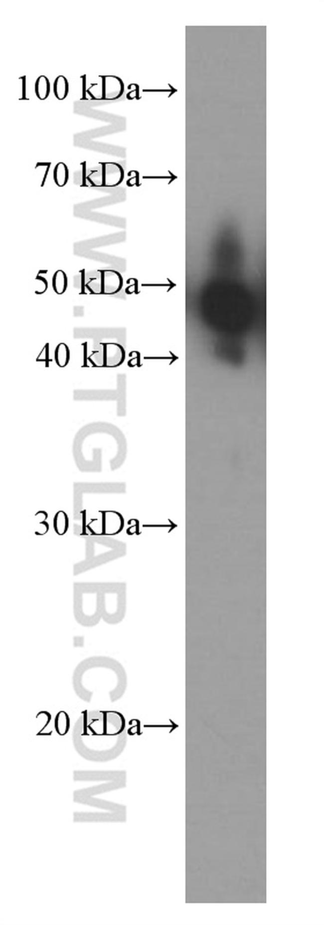 NSE Antibody in Western Blot (WB)