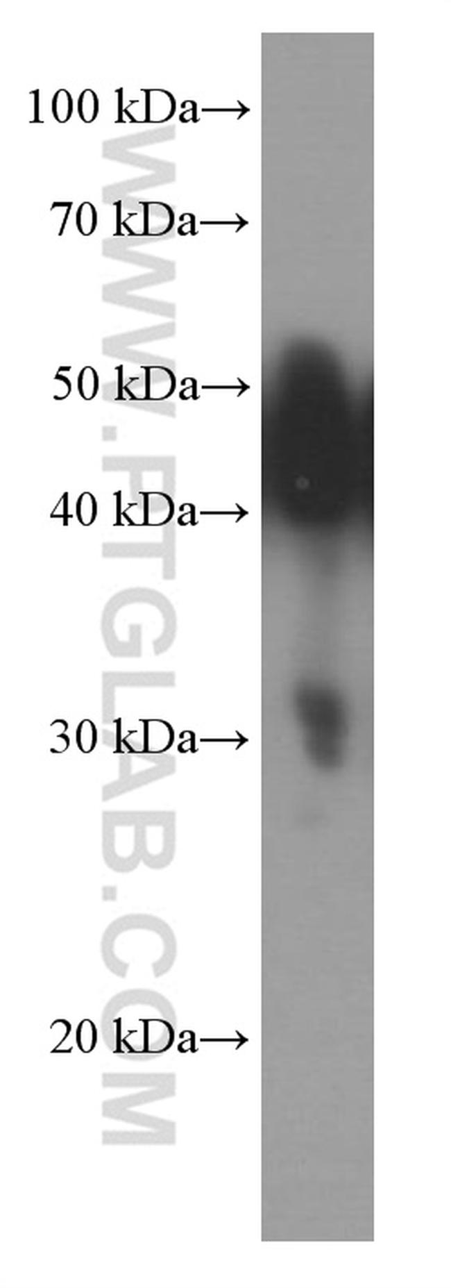 NSE Antibody in Western Blot (WB)