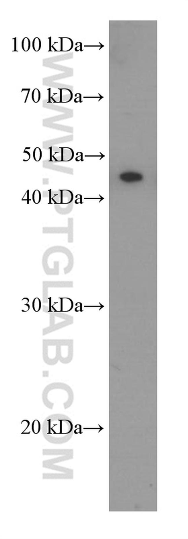 NSE Antibody in Western Blot (WB)