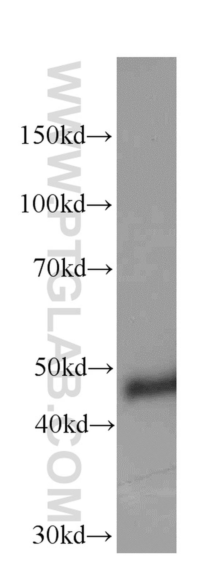 NSE Antibody in Western Blot (WB)