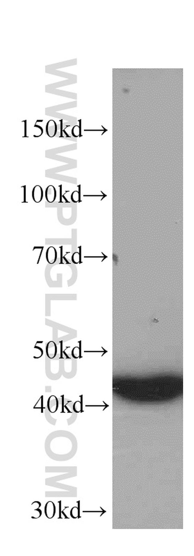 NSE Antibody in Western Blot (WB)