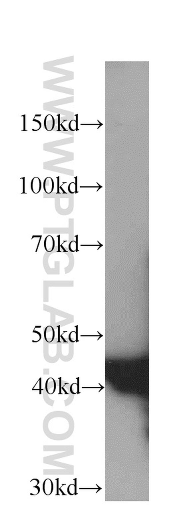 NSE Antibody in Western Blot (WB)