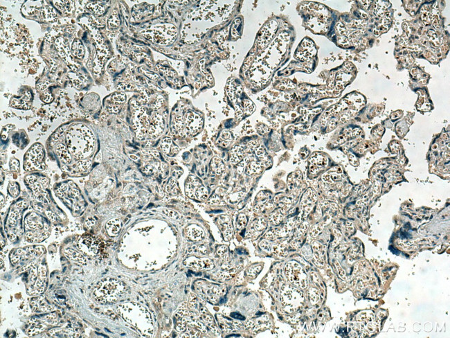 HBE1 Antibody in Immunohistochemistry (Paraffin) (IHC (P))