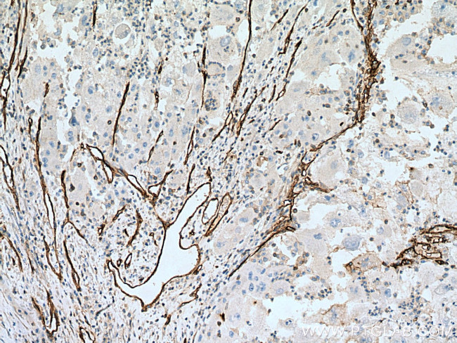 CD146/MCAM Antibody in Immunohistochemistry (Paraffin) (IHC (P))