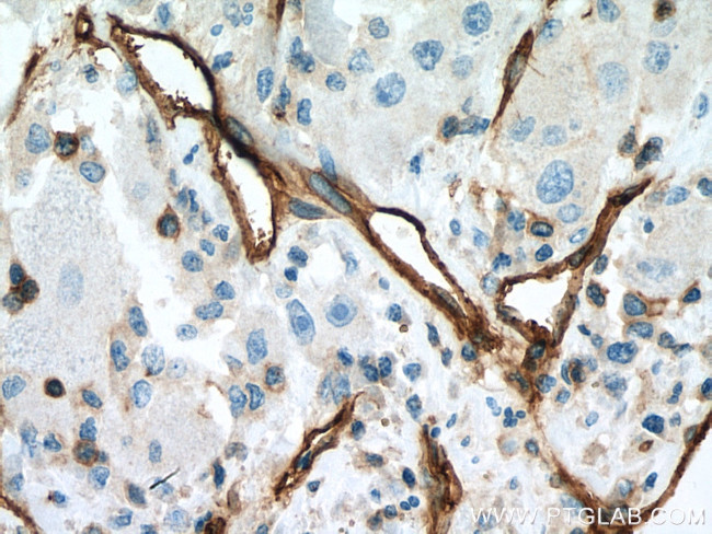 CD146/MCAM Antibody in Immunohistochemistry (Paraffin) (IHC (P))