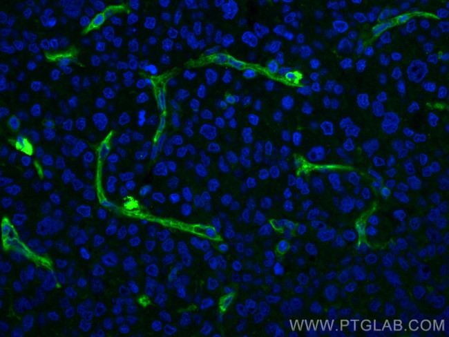 CD146/MCAM Antibody in Immunohistochemistry (PFA fixed) (IHC (PFA))