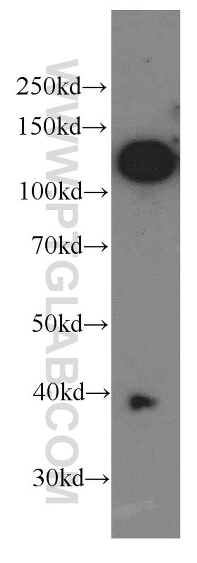 CD146/MCAM Antibody in Western Blot (WB)