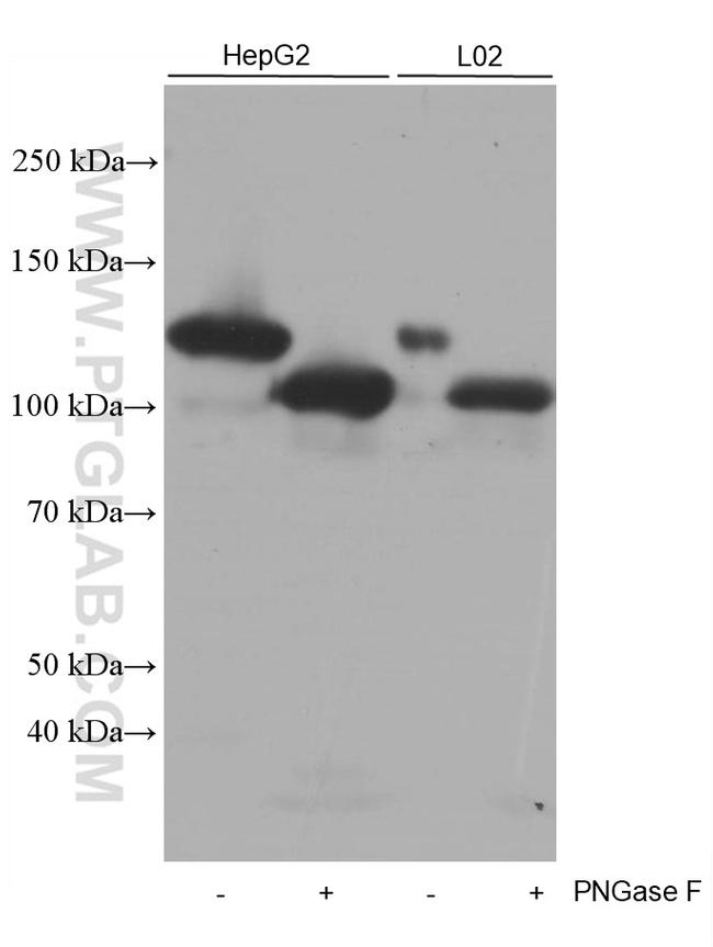 CD146/MCAM Antibody in Western Blot (WB)