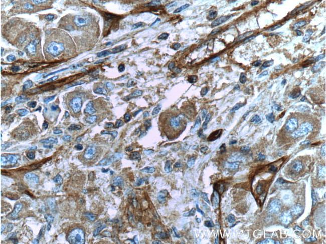 CD146/MCAM Antibody in Immunohistochemistry (Paraffin) (IHC (P))