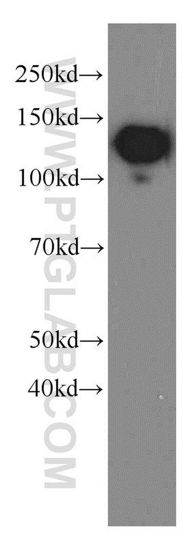 CD146/MCAM Antibody in Western Blot (WB)