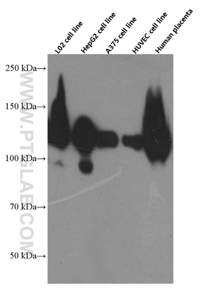 CD146/MCAM Antibody in Western Blot (WB)