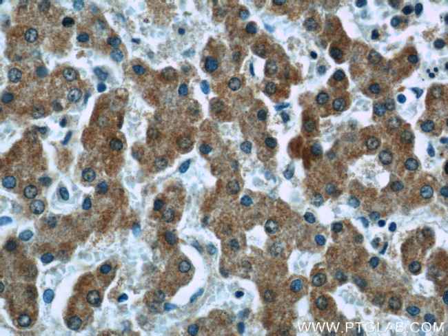 Complement factor B Antibody in Immunohistochemistry (Paraffin) (IHC (P))