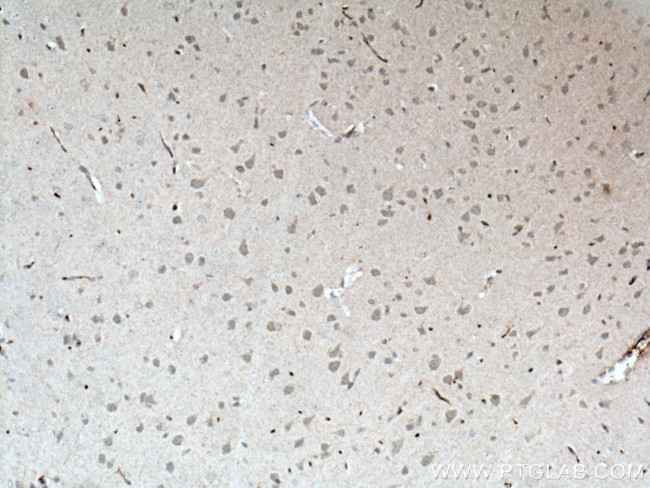 NUMBL Antibody in Immunohistochemistry (Paraffin) (IHC (P))