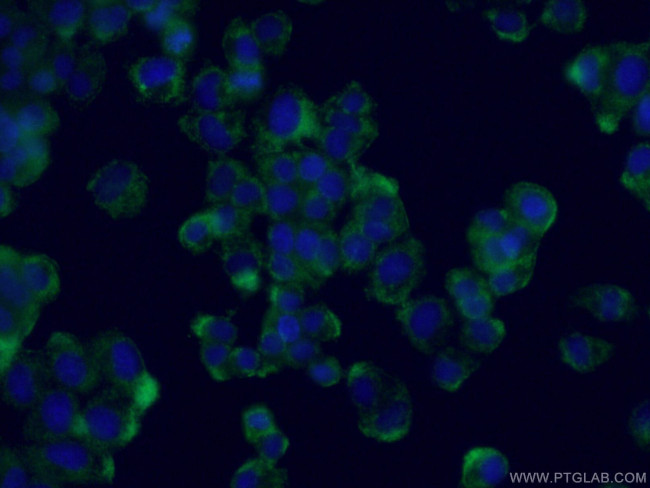 NUMBL Antibody in Immunocytochemistry (ICC/IF)