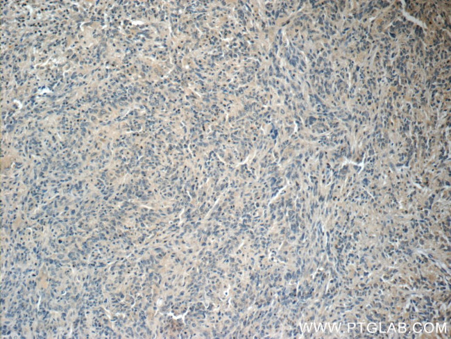 NUMBL Antibody in Immunohistochemistry (Paraffin) (IHC (P))