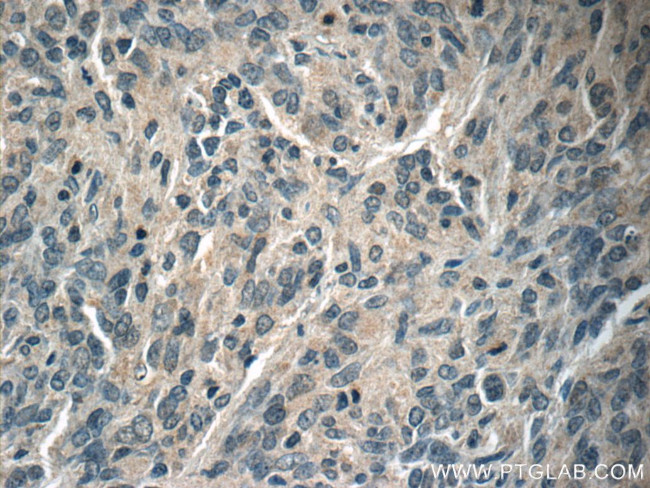 NUMBL Antibody in Immunohistochemistry (Paraffin) (IHC (P))