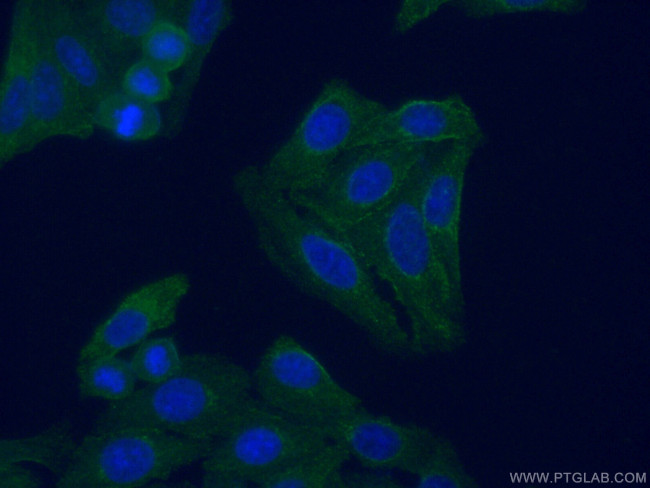 C3/C3b/C3c Antibody in Immunocytochemistry (ICC/IF)