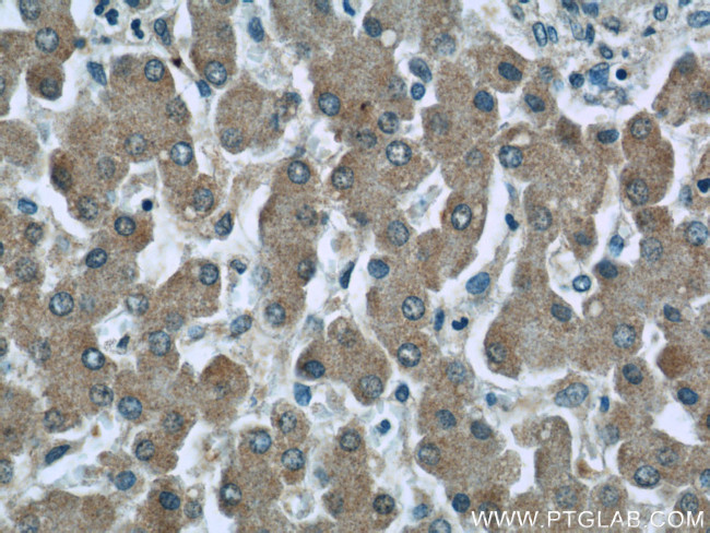 C3/C3b/C3c Antibody in Immunohistochemistry (Paraffin) (IHC (P))