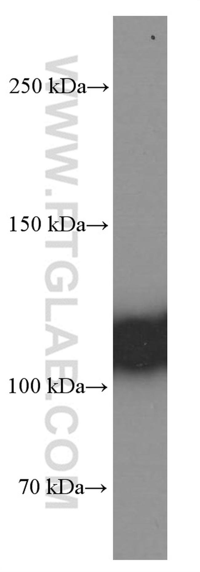 C3/C3b/C3c Antibody in Western Blot (WB)