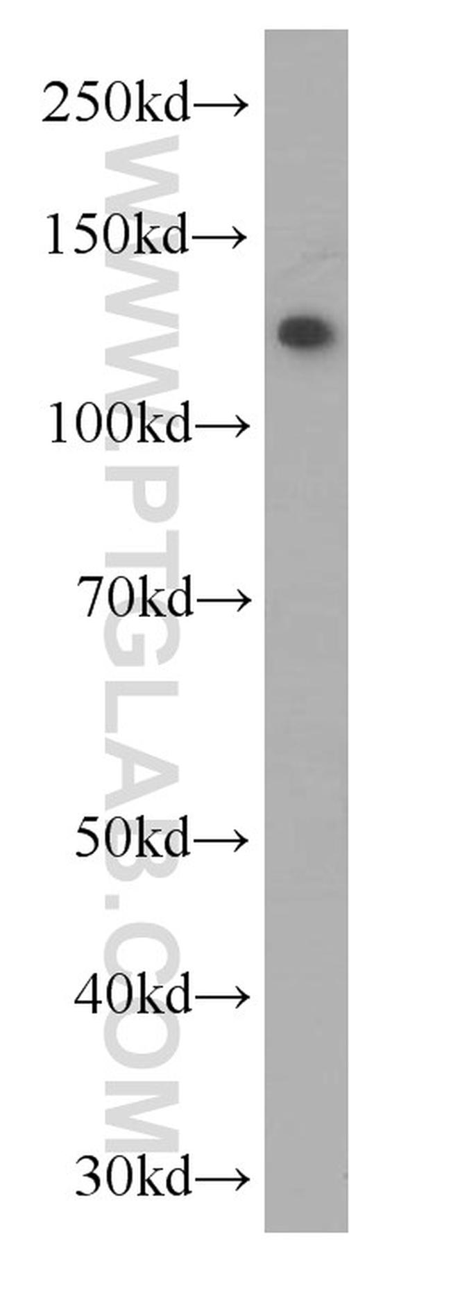 C3/C3b/C3c Antibody in Western Blot (WB)