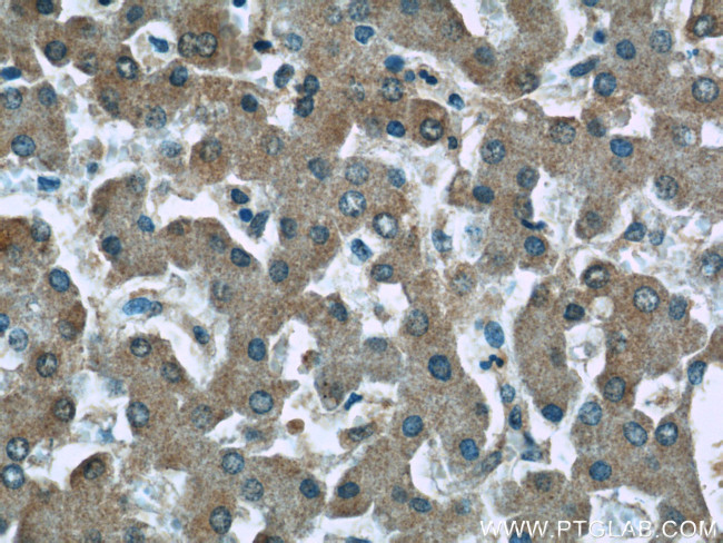 Fibrinogen gamma chain Antibody in Immunohistochemistry (Paraffin) (IHC (P))