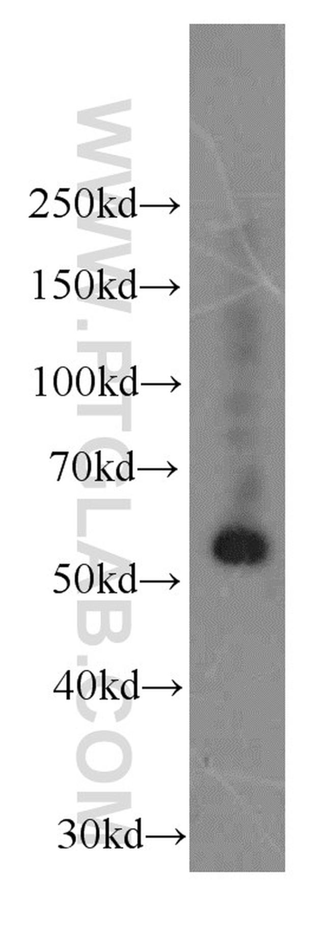 Fibrinogen gamma chain Antibody in Western Blot (WB)