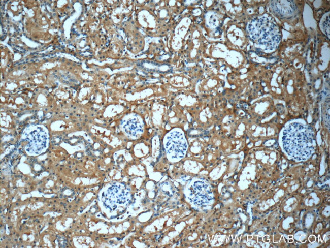 Fibrinogen gamma chain Antibody in Immunohistochemistry (Paraffin) (IHC (P))