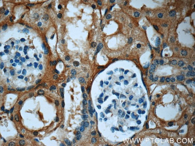 Fibrinogen gamma chain Antibody in Immunohistochemistry (Paraffin) (IHC (P))