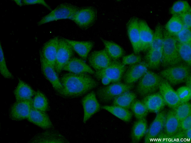 NAPRT1 Antibody in Immunocytochemistry (ICC/IF)