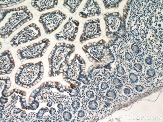 NAPRT1 Antibody in Immunohistochemistry (Paraffin) (IHC (P))