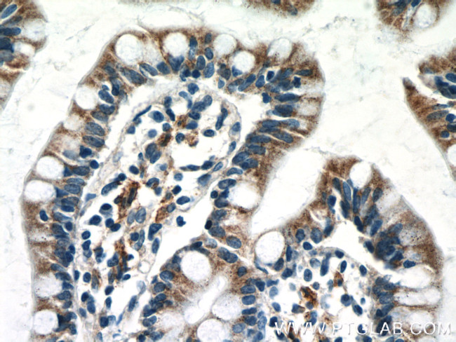 NAPRT1 Antibody in Immunohistochemistry (Paraffin) (IHC (P))