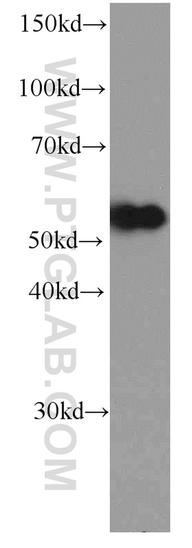 NAPRT1 Antibody in Western Blot (WB)