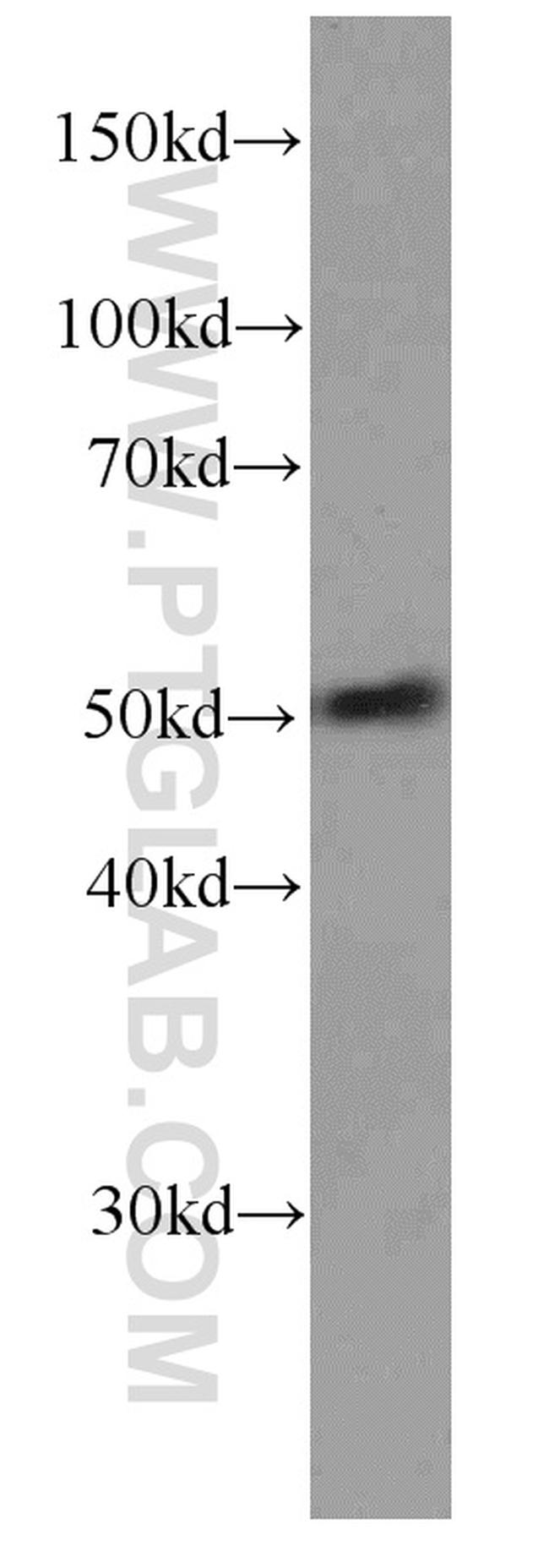 NAPRT1 Antibody in Western Blot (WB)