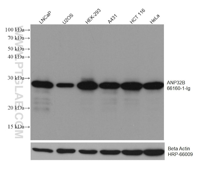 ANP32B Antibody in Western Blot (WB)