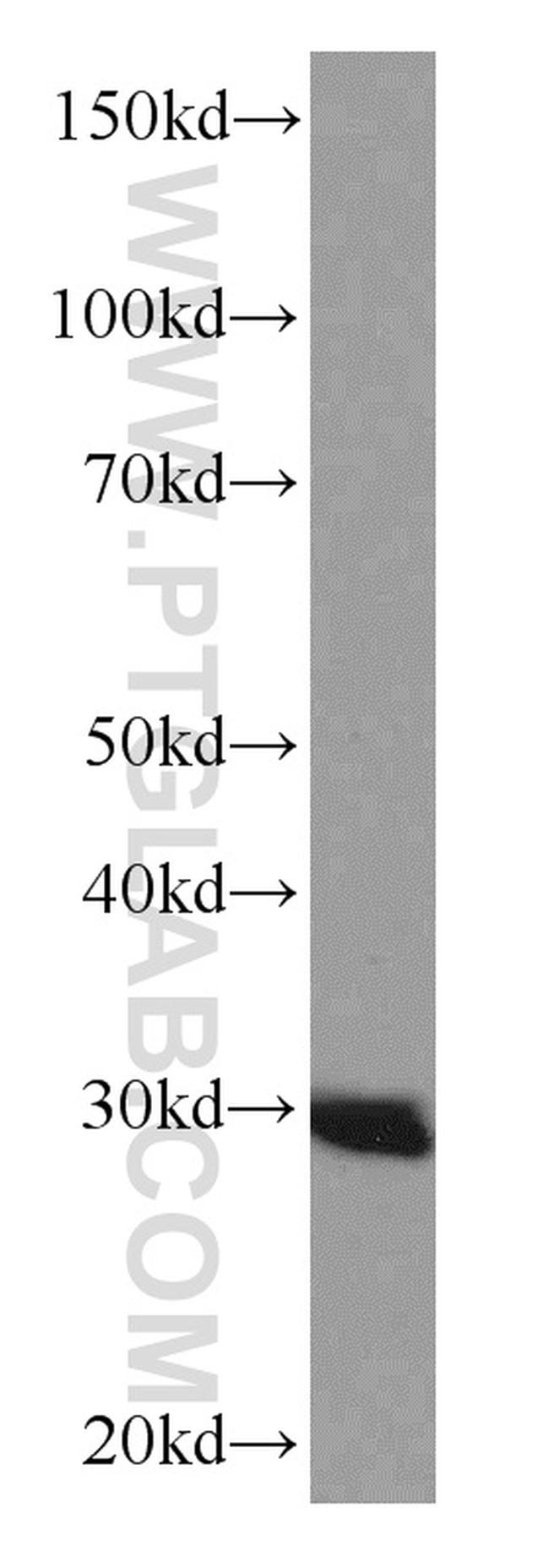 ANP32B Antibody in Western Blot (WB)