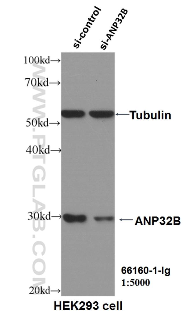 ANP32B Antibody in Western Blot (WB)