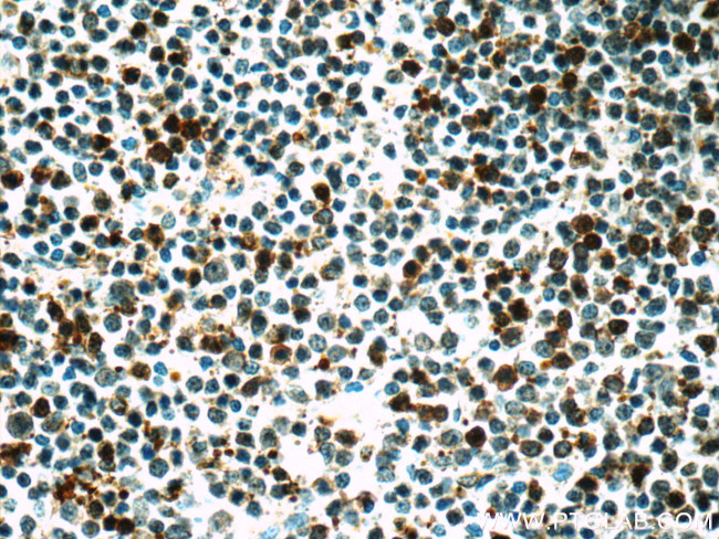 BMI1 Antibody in Immunohistochemistry (Paraffin) (IHC (P))