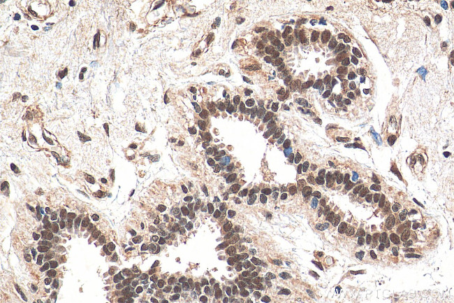 BMI1 Antibody in Immunohistochemistry (Paraffin) (IHC (P))