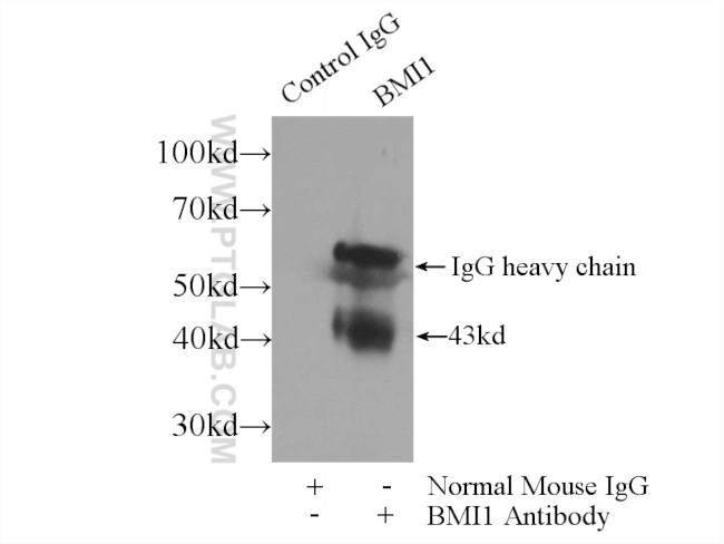 BMI1 Antibody in Immunoprecipitation (IP)