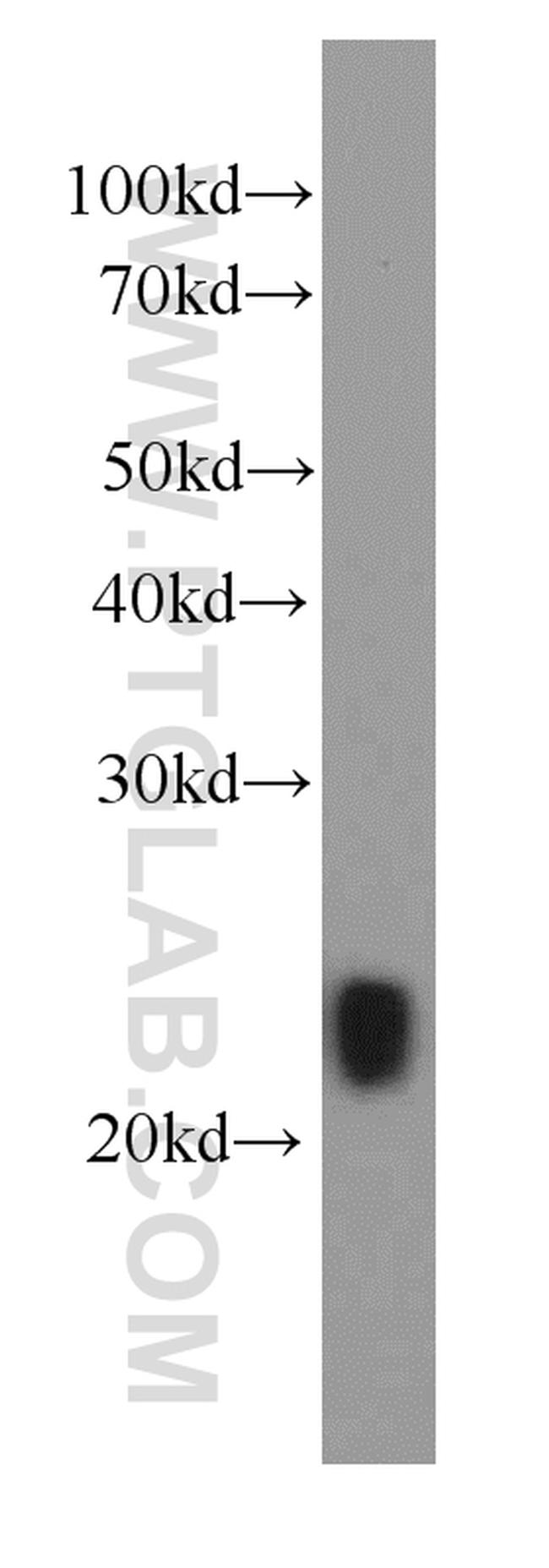 IL-29 Antibody in Western Blot (WB)