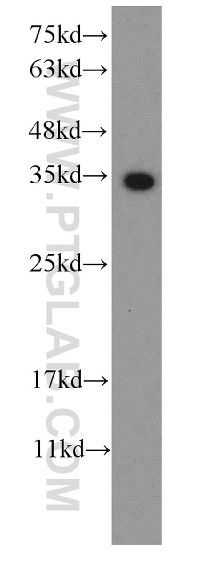 S1 tag Antibody in Western Blot (WB)