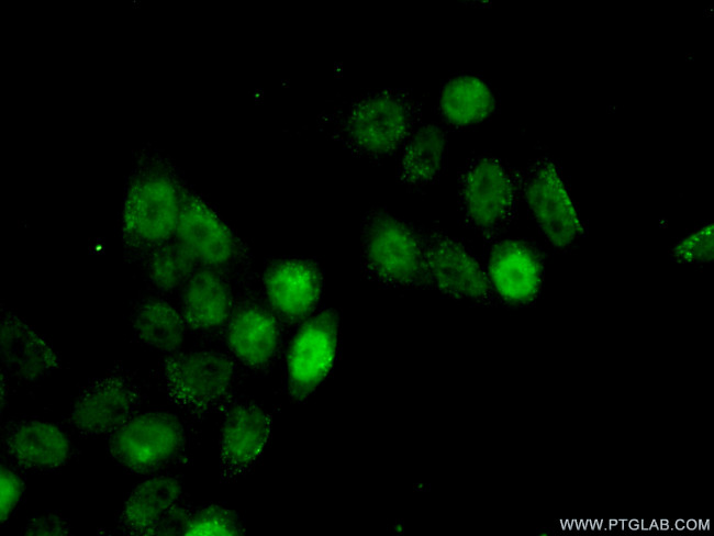 TBP Antibody in Immunocytochemistry (ICC/IF)