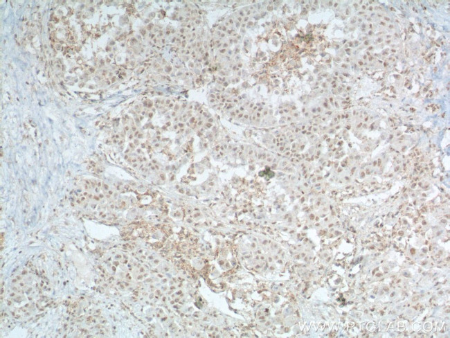 TBP Antibody in Immunohistochemistry (Paraffin) (IHC (P))