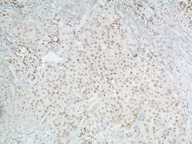 TBP Antibody in Immunohistochemistry (Paraffin) (IHC (P))