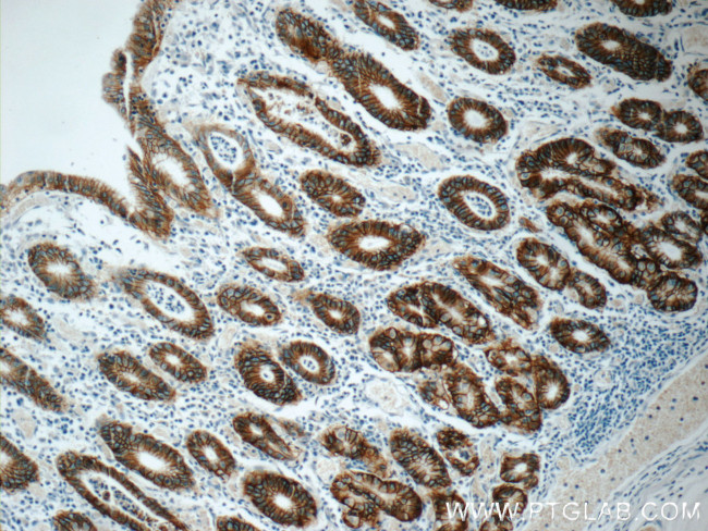 Claudin 18 Antibody in Immunohistochemistry (Paraffin) (IHC (P))